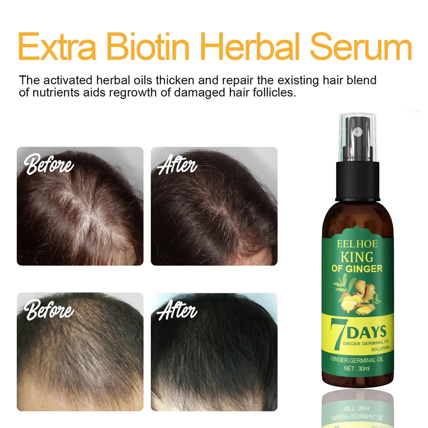 Ginger Hair Growth Germinal Oil, Regrow 7 Days