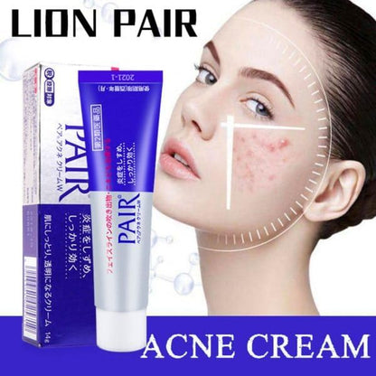 Lion PAIR Acne Cream W Reduces Itching Blemishes Rashes Redness 2X24 G