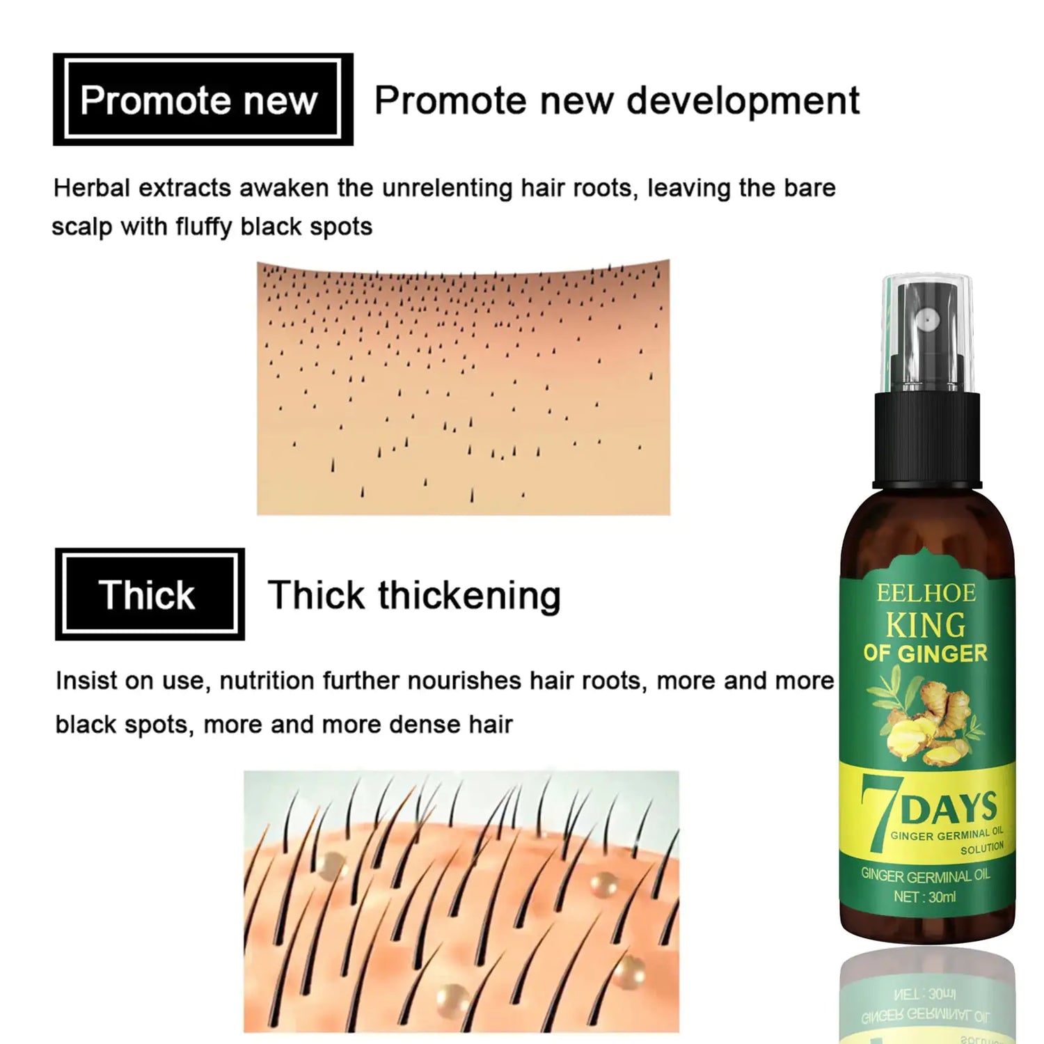 Ginger Hair Growth Germinal Oil, Regrow 7 Days