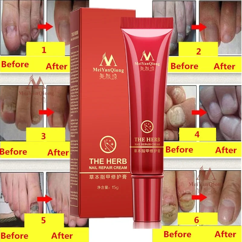 Herbal Nail Cream Repair